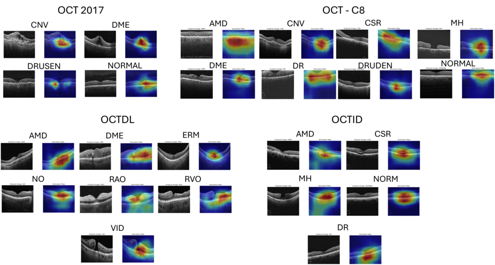 Oct Serial Raster A Lightweight Multi-Scale Dilated Convolutional Network for Retinal ...
